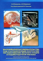 Малоинвазивные вмешательства под ультразвуковым контролем при заболеваниях желчного пузыря и поджелудочной железы артикул 13277d.